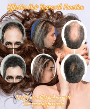 ActiveScalp Hair Regrowth Essence Intensive Spray Pakistan